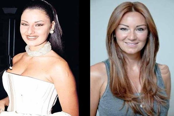 Pınar Altuğ şaşırttı! Ona bir de estetiksiz bakın