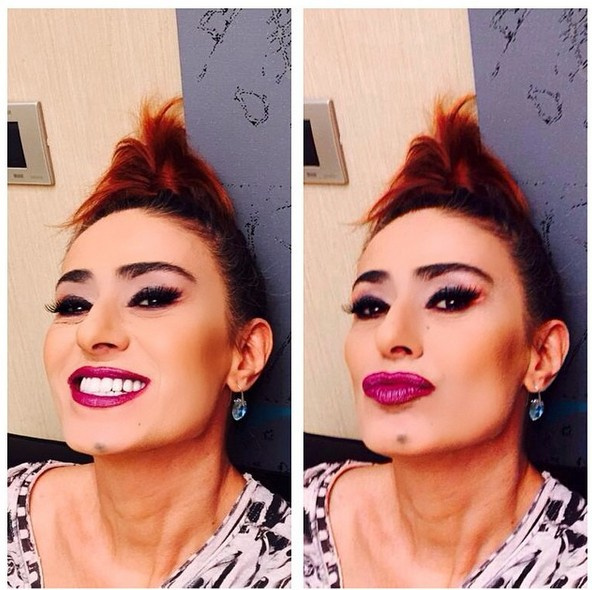 Yıldız Tilbe�nin son hali şok etti! Her yerine yayılıyor