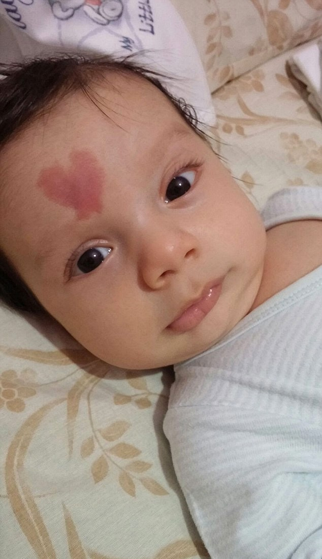 Dünya alnında kalp olan Türk bebeği konuşuyor!
