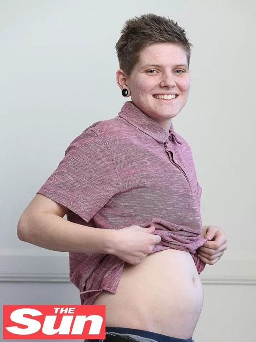 20 yaşındaki genç adam 4 aylık hamile inanılmaz!