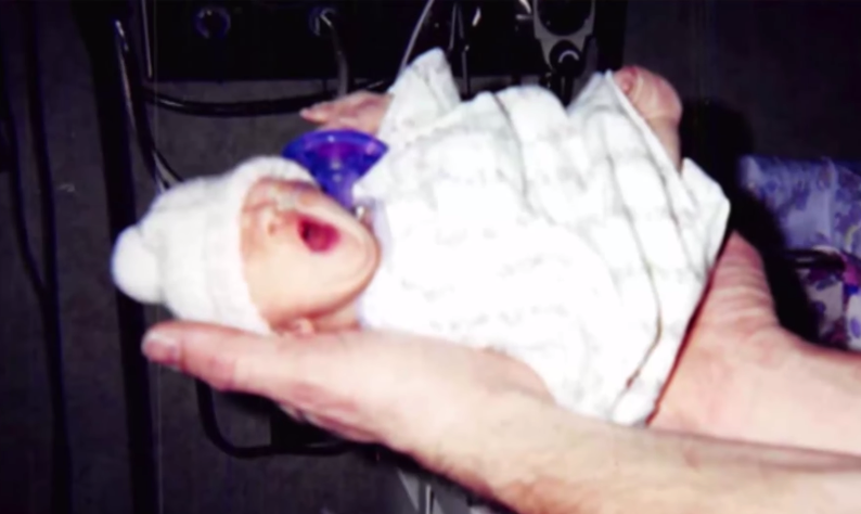 O dünyanın en küçük bebeği sadece 1.1 kilo ama bakın ne yaptı