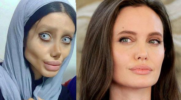 Angelina Jolie’ye benzemek istedi! Sonuç korkunç