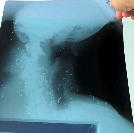 Yaralı köpeğin röntgeni şoke etti