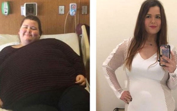 Böyle değişim görülmedi 15 ayda verdiği kiloya bakın!