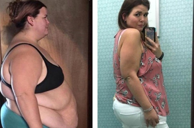 Böyle değişim görülmedi 15 ayda verdiği kiloya bakın!