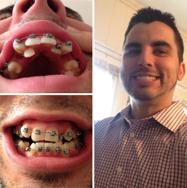 Dişlerini yaptıran insanların muhteşem değişimi