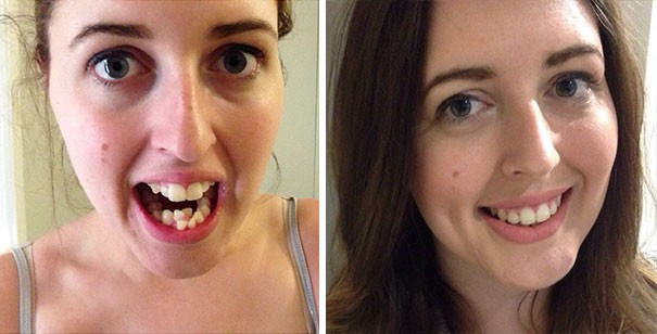 Dişlerini yaptıran insanların muhteşem değişimi