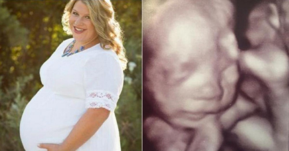 Eşi vefat ettikten sonra hamile olduğunu öğrendi ultrasonda müjdeyi aldı