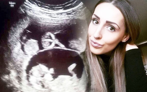 Taşıyıcı anne oldu ama ultrasonda girince gözlerine inanamadı!