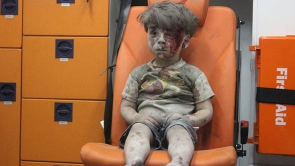 Bombalı saldırıda yaralanmıştı Ümran bebeğin son haline bakın