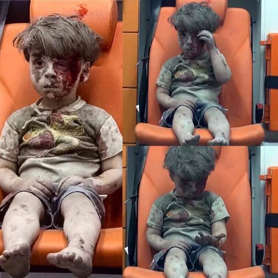 Bombalı saldırıda yaralanmıştı Ümran bebeğin son haline bakın