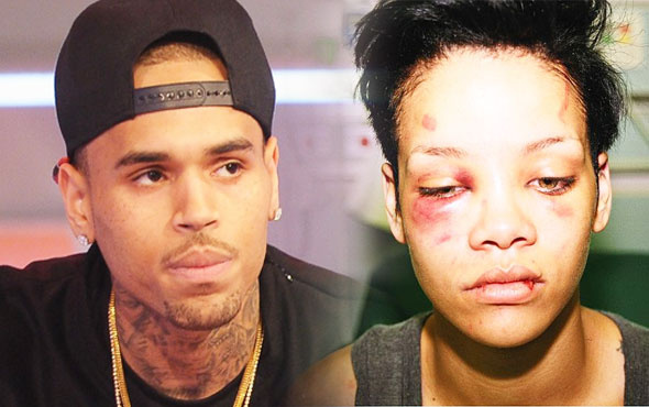 Bu hale o getirmişti Chris Brown Rihanna'yı dövdüğünü böyle anlattı