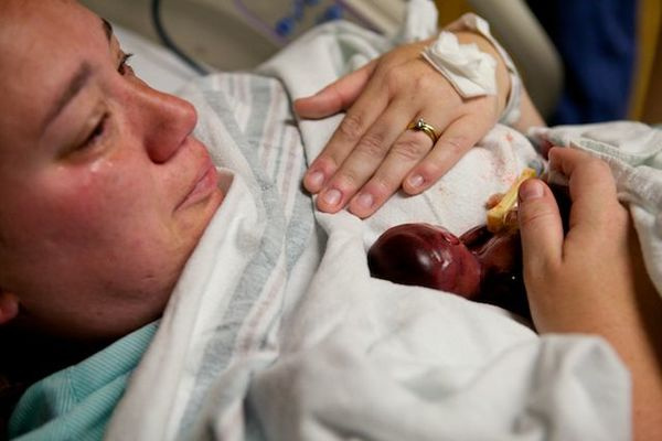 19 haftalık dünyaya geldi bebeği gören herkes şoke oldu