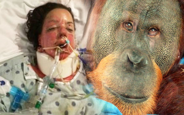 Hayatını karartan kazadan sonra onu hayata orangutan döndürdü