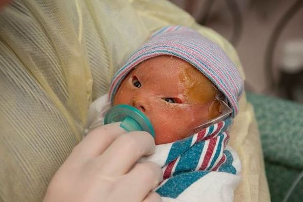 Bebeği gördüğünde gözlerine inanamadı doktorlar kaçıştı!