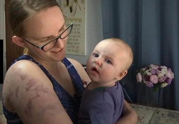 Şiddetli doluya yakalandı 4 aylık oğlunu korumak için bu hale geldi!
