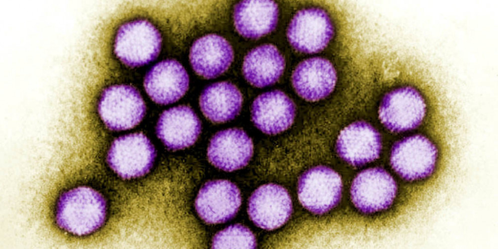 ABD'deki virüs salgınında 6 çocuk hayatını kaybetti