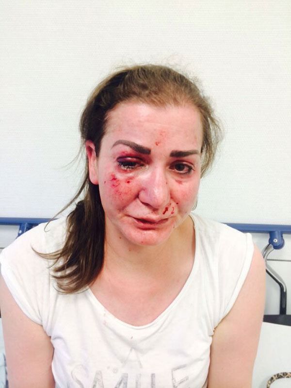 Almanya'da Türk kadına tramvayda vahşi saldırı! Örtbas mı ediliyor?