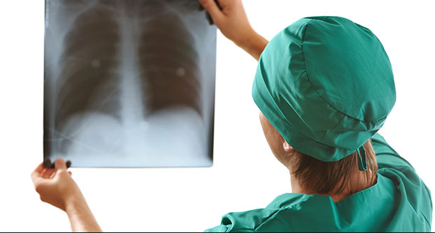 Akciğer lekesi nedir belirtileri nelerdir? Tedavisi var mıdır?