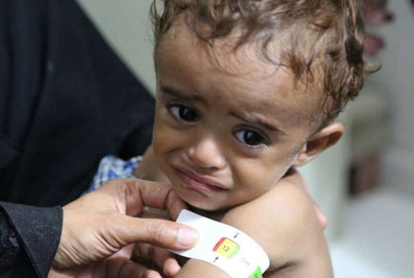 85 bin bebek açlıktan hayatını kaybetti Yemen kan ağlıyor