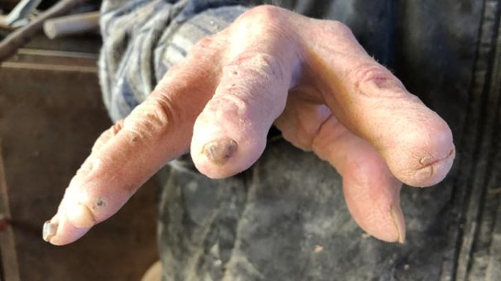 72 yıldır ürettiği fıçılar yüzünden elleri bu hale geldi!