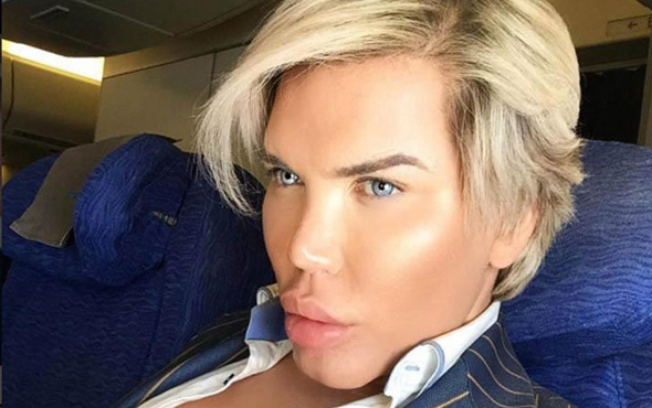 Rodrigo Alves bu sefer Brezilya kalçası yaptırdı