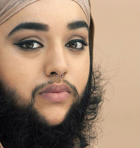 Bu işte bir terslik var sakallı kadın yıllardır sakallarını kesmiyor