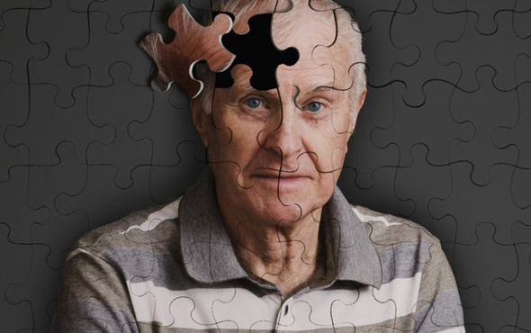 Alzheimer nedir belirtileri nelerdir ? İşte dikkat etmeniz gerekenler..