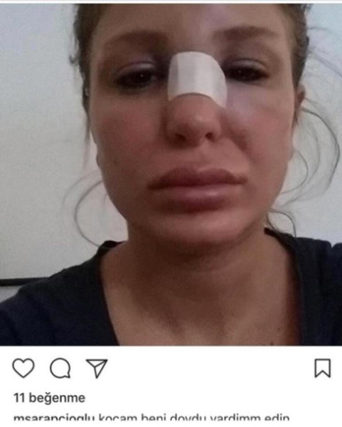 Berk Oktay Merve Şarapçıoğlu'nun yine çıplak fotoğrafları sızdı skandal görüntüler