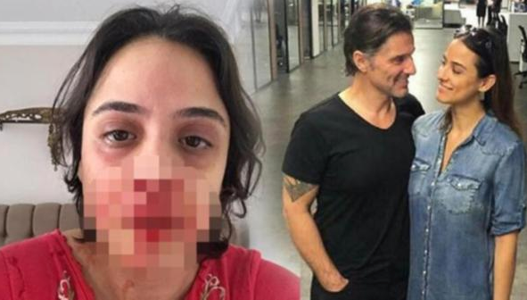 Sevgilisini bu hale getirmişti! Hazım Körmükçü'den şoke eden haber - Sayfa 2