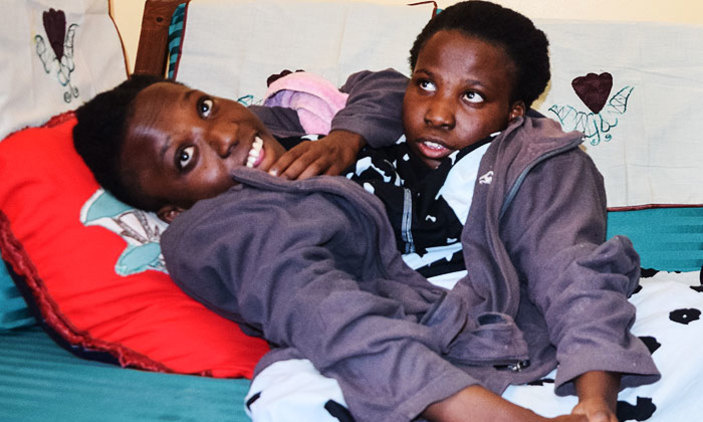 Tanzanya’nın ünlü yapışık ikizleri öldü