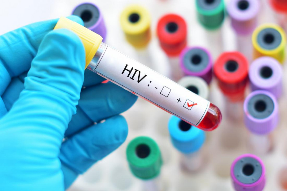 HIV salgınının yeniden alevleneceği uyarısı!