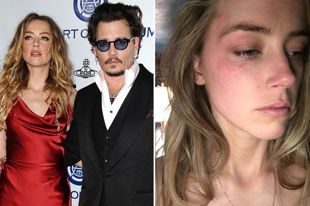 Johnny Depp’in içler acısı halinin nedeni ortaya çıktı