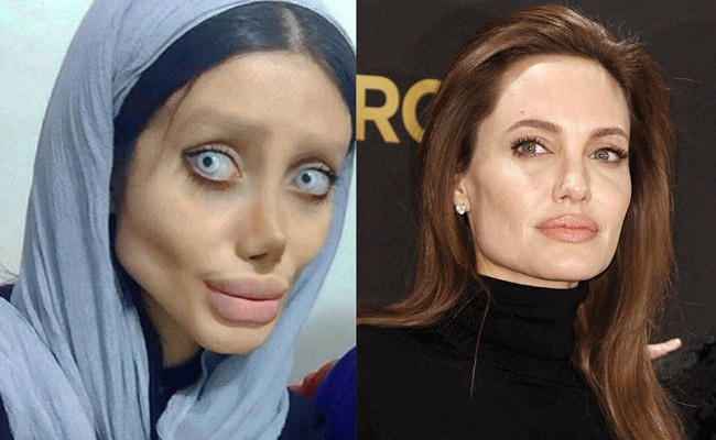Angelina Jolie'ye benzemeye çalışan İranlı kadının son hali şoke etti!