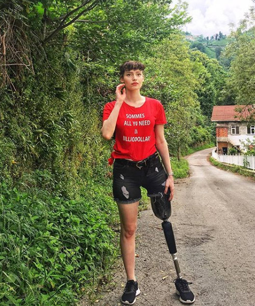 Kanser ondan bacağını almıştı Neslihan Tay 3. kez kansere yakalandı!
