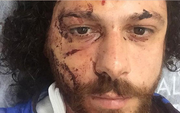 Ünlü oyuncu Oral Özer bar saldırısında hastanelik oldu