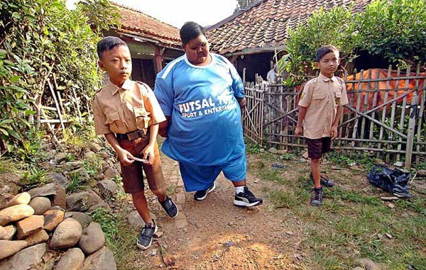 Dünyanın en kilolu çocuğuydu son haline bakın