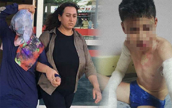 Konya'da komşu dehşeti: Çocuklara kezzap döktü!