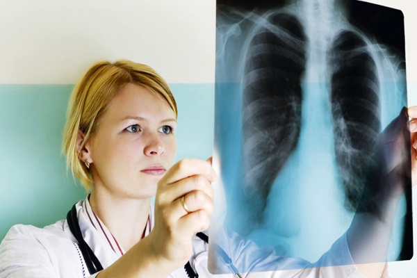 Akciğer kanserinin ilk evre belirtilerine dikkat!