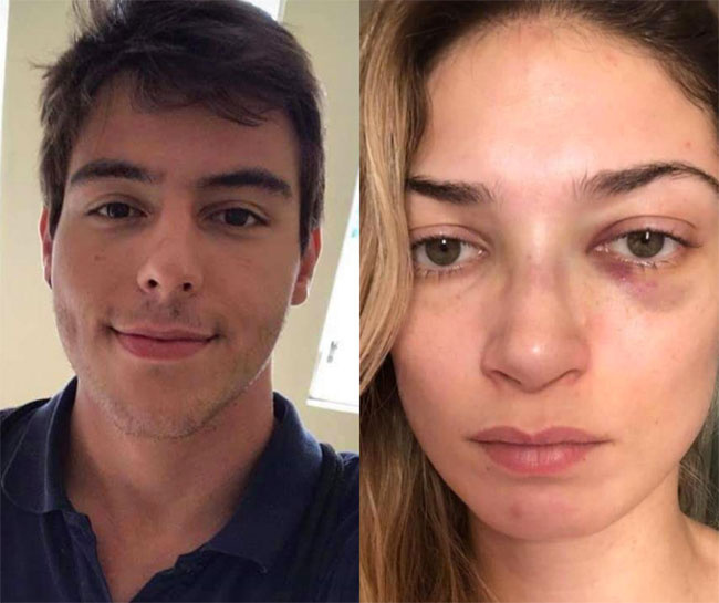 Genç pilot, avukat sevgilisini kamera önünde hunharca dövdü 