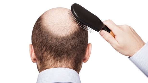 Saç dökülmesine çözüm B12 vitamini C vitamini ise saçı uzatıyor