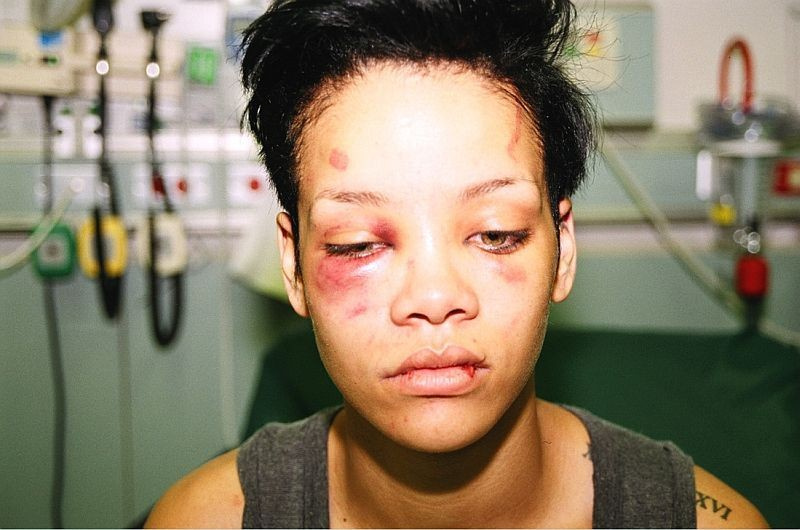 Ünlü rapçi tecavüzden tutuklandı Rihanna'yı hastanelik etmişti... 