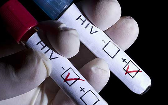 Binlerce HIV hastasının kimlik bilgileri sızdırıldı