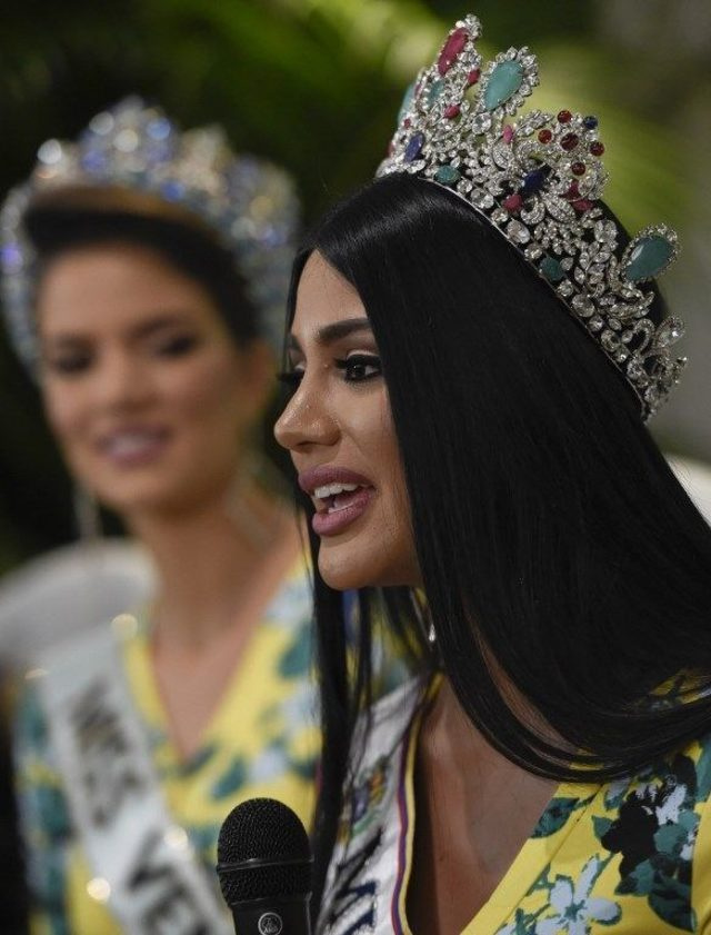 Venezuela Güzeli estetikli çıktı! Doktorundan bomba açıklama