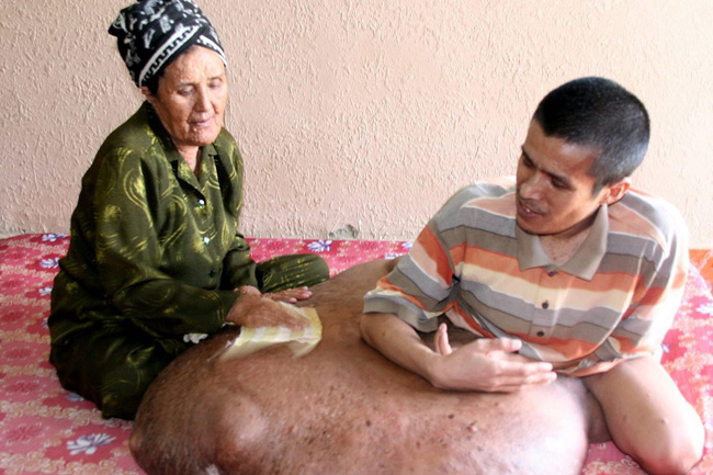 Dünya bu fotoğrafa şok oldu!