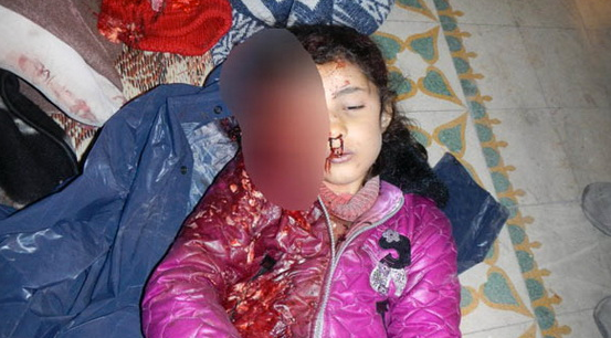 Suriye'deki katliamın en acı fotoğrafları