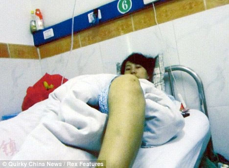 Çin'den olay kürtaj fotoğrafları