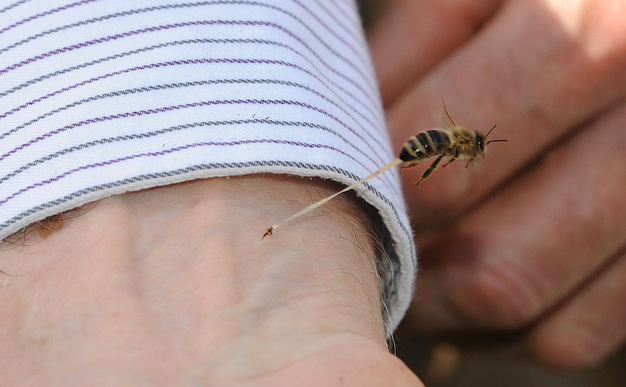 İşte arının insanı soktuğu an 