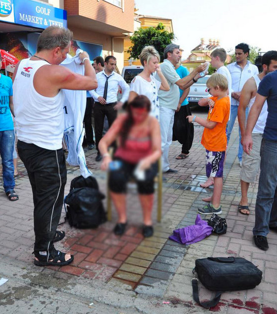 Alanya'da turistler kaza geçirdi