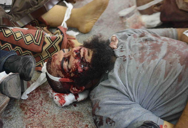 Mısır'daki katliamın şoke eden fotoğrafları